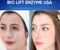 Da mặt chảy xệ tuổi 30 - Giải pháp tăng sinh collagen để da đàn hồi và trẻ hóa không cần phẫu thuật